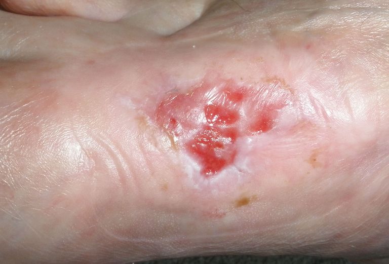 ....macht's wieder schlimmer :-(