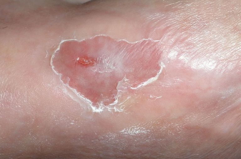 Hoffentlich nicht wieder nur ein Intermezzo