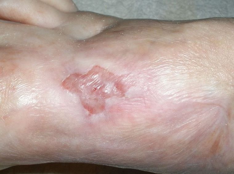 ...geht's nicht mehr zurück