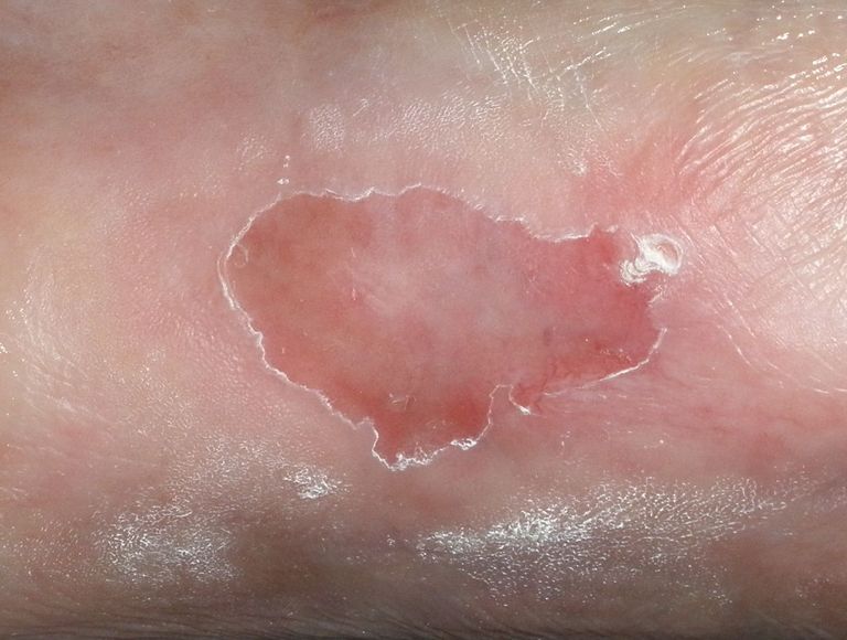 es muss jetzt nur noch so bleiben und stabil werden