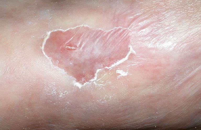 ...der Endspurt werden?