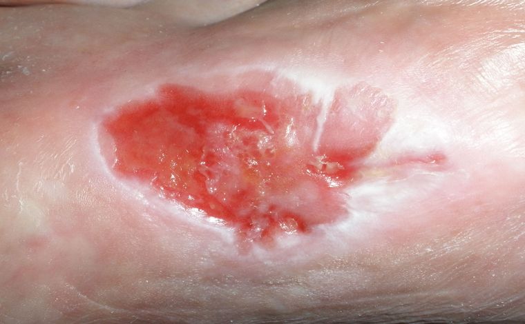 Sieht seltsam aus, ist aber so