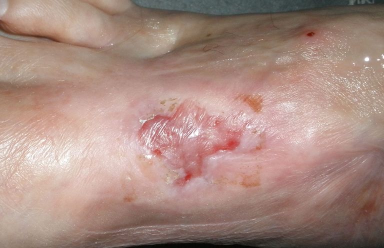 ....funktioniert halt doch.