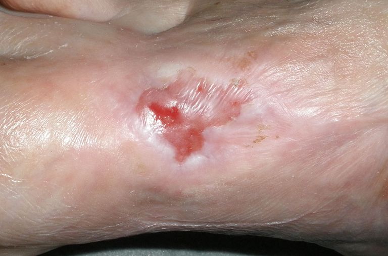 ......macht auch ihm zu schaffen.