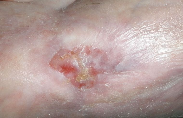 ..jetzt wird's wieder besser