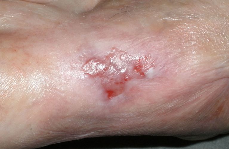 Langsam wird's nervig