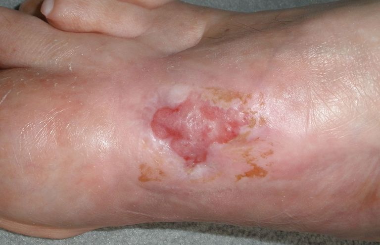 ....wird eine neue Therapie angewandt.