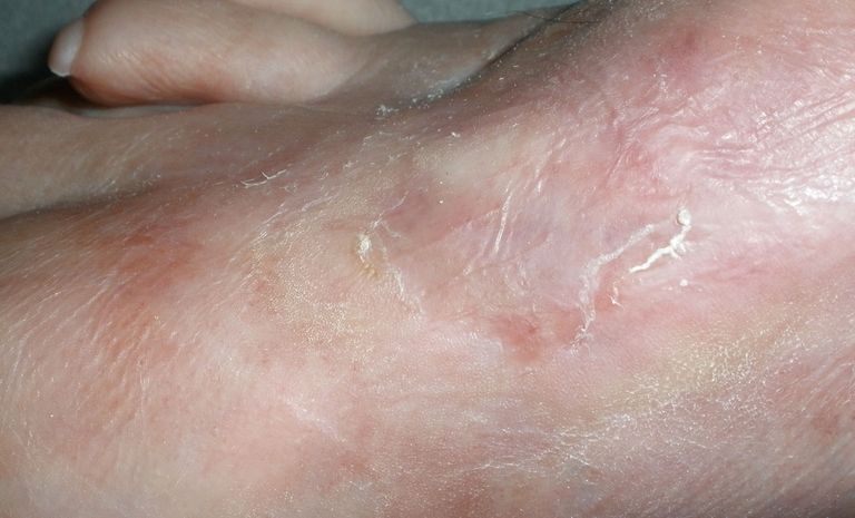 Es muss sich nur noch 100% stabilisieren