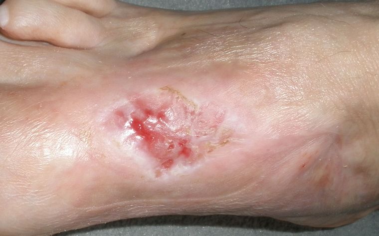 ....dann dauert's nicht mehr lang.