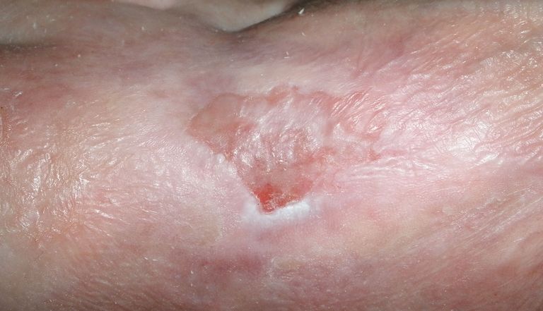 ....zu stabilisieren:-)